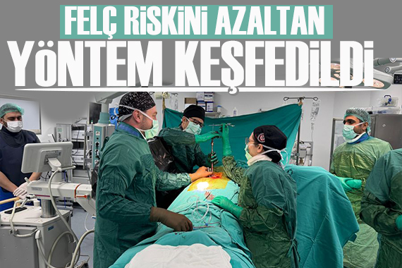 Türk doktordan felç riskini azaltan yeni cerrahi yöntem tıp literatürüne girdi
