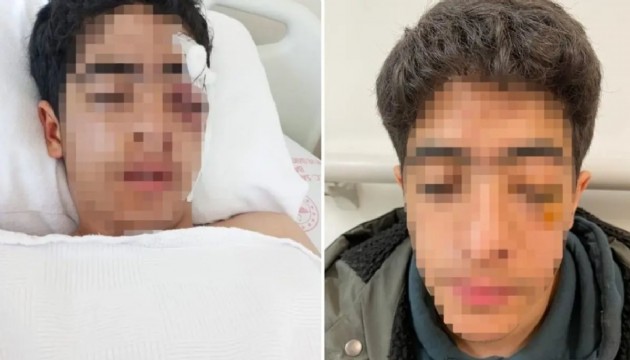 15 yaşındaki çocuğa akranından muştalı saldırı