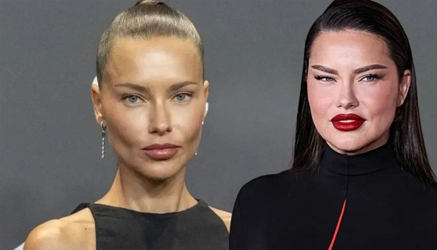 Adriana Lima'nın eski halinden eser kalmadı!