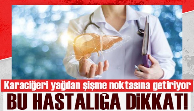 Uzmanından korkutan açıklama: Karaciğeri yağdan şişme noktasına getiriyor!