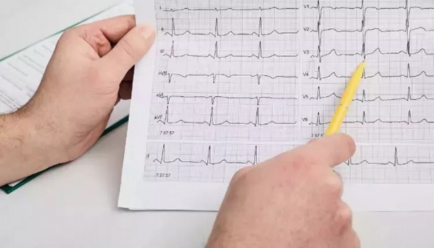 EKG'de yapay zeka dönemi!