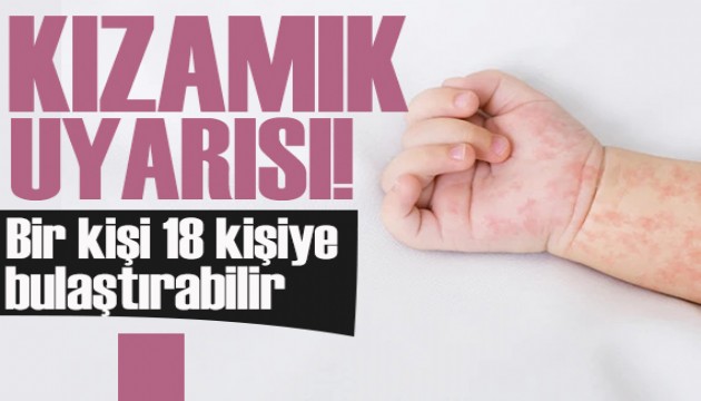 Uzmanından 'kızamık' uyarısı: Bir kişi 18 kişiye bulaştırabilir