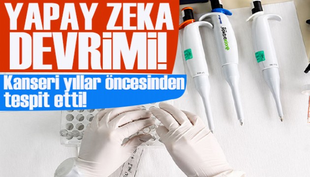 Yapay zeka en ölümcül Pankreas kanserini yıllar önceden tespit etti