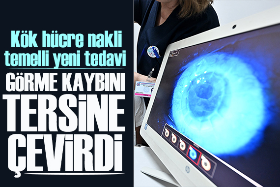 Kök hücre nakli temelli yeni tedavi, görme kaybını tersine çevirdi