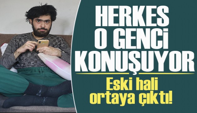 Yıllardır duş almayan ve tırnaklarını kesmeyen 23 yaşındaki gencin eski hali ortaya çıktı!