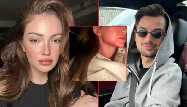 Danla Bilic saplantılı şahıs hakkında konuştu