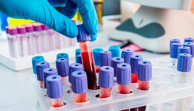 En çok grip olan kan grubu meğer buymuş! Hemen şifayı kapıyorlar!