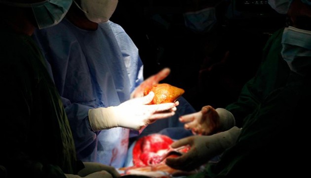 Her kan grubuna uyumlu “evrensel böbrek” üretildi