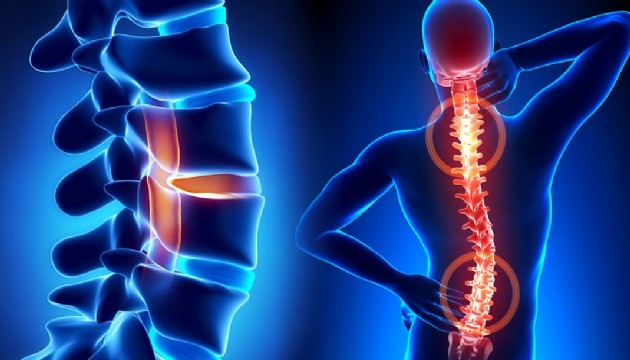 Uzmanından dikkat çeken açıklama: Bel, boyun ve eklem ağrılarında ciddi bir artış var