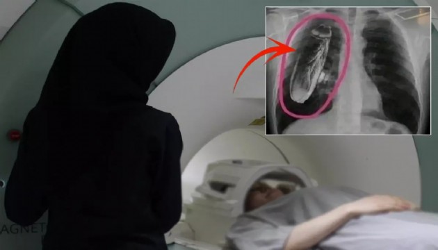 Hastaya 'Göğsünde canlı böcek var' dendi, gerçek çok başka çıktı