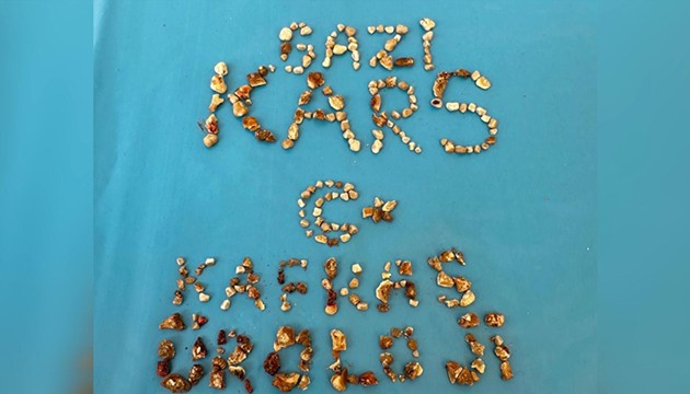 İki böbreğinden 300'den fazla taş çıktı