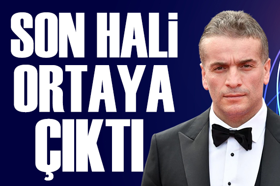 Hayranlarını korkutmuştu: Murat Cemcir'in son hali ortaya çıktı