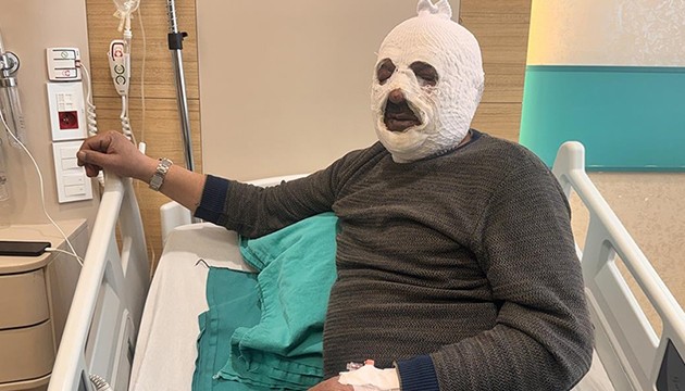 Kalorifer kazanı canından ediyordu