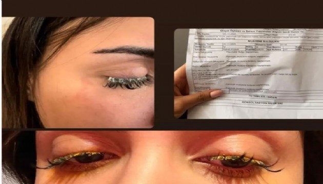 Güzellik merkezi yüzünden kör oluyordu