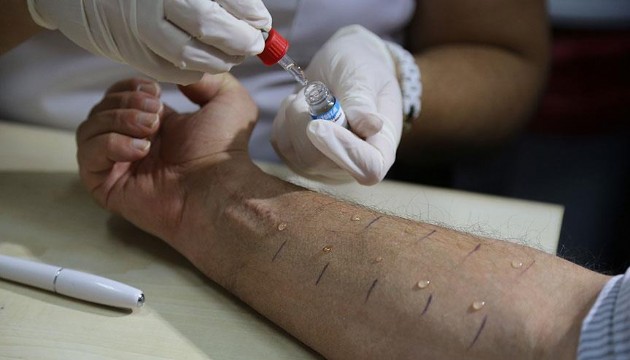 Gıda alerjilerinde ihmal ölümle sonuçlanabiliyor