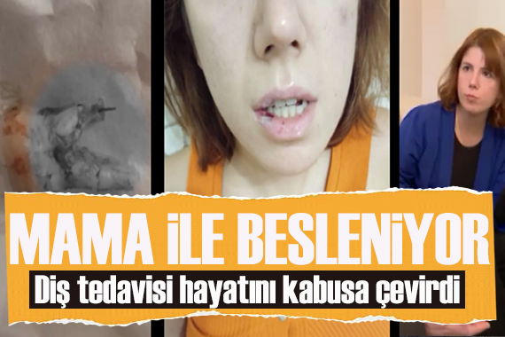 Diş ağrısıyla gitti, hayatı kabusa döndü!