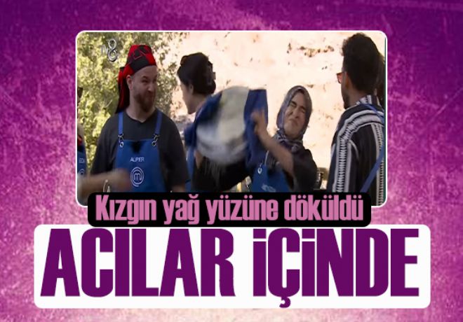 Kızgın yağ yüzüne döküldü! MasterChef Beyza'nın yandığı görüntüler yayınlandı!